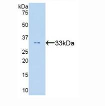 人信号传导转录激活因子6(STAT6)多克隆抗体