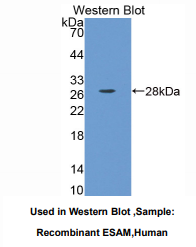 https://msimg.bioon.com/bionline/goods-no-pic.png