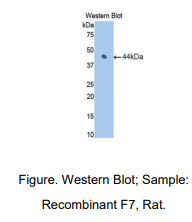 https://msimg.bioon.com/bionline/goods-no-pic.png