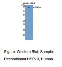 人热休克蛋白70(HSP70)多克隆抗体