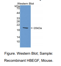 https://msimg.bioon.com/bionline/goods-no-pic.png