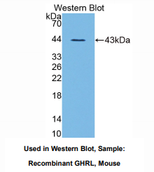 https://msimg.bioon.com/bionline/goods-no-pic.png