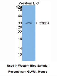 https://msimg.bioon.com/bionline/goods-no-pic.png