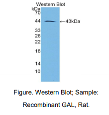 https://msimg.bioon.com/bionline/goods-no-pic.png