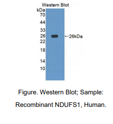 https://msimg.bioon.com/bionline/goods-no-pic.png