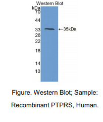 人蛋白酪氨酸磷酸酶受体S(PTPRS)多克隆抗体
