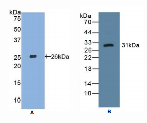 人凝集素样氧化低密度脂蛋白受体1(LOX1)多克隆抗体