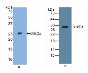 https://msimg.bioon.com/bionline/goods-no-pic.png