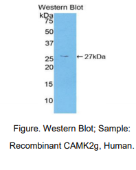人钙/钙调蛋白依赖性蛋白激酶Ⅱγ(CAMK2g)多克隆抗体