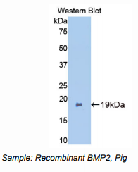 猪骨成型蛋白2(BMP2)多克隆抗体