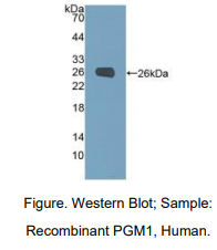 https://msimg.bioon.com/bionline/goods-no-pic.png