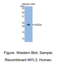 人肌球蛋白轻链3(MYL3)多克隆抗体