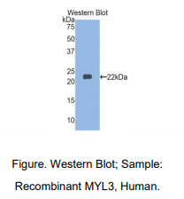 https://msimg.bioon.com/bionline/goods-no-pic.png