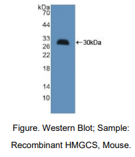 小鼠羟甲基戊二酰辅酶A合酶(HMGCS)多克隆抗体