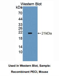 https://msimg.bioon.com/bionline/goods-no-pic.png