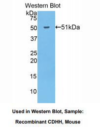 https://msimg.bioon.com/bionline/goods-no-pic.png