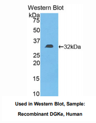 https://msimg.bioon.com/bionline/goods-no-pic.png