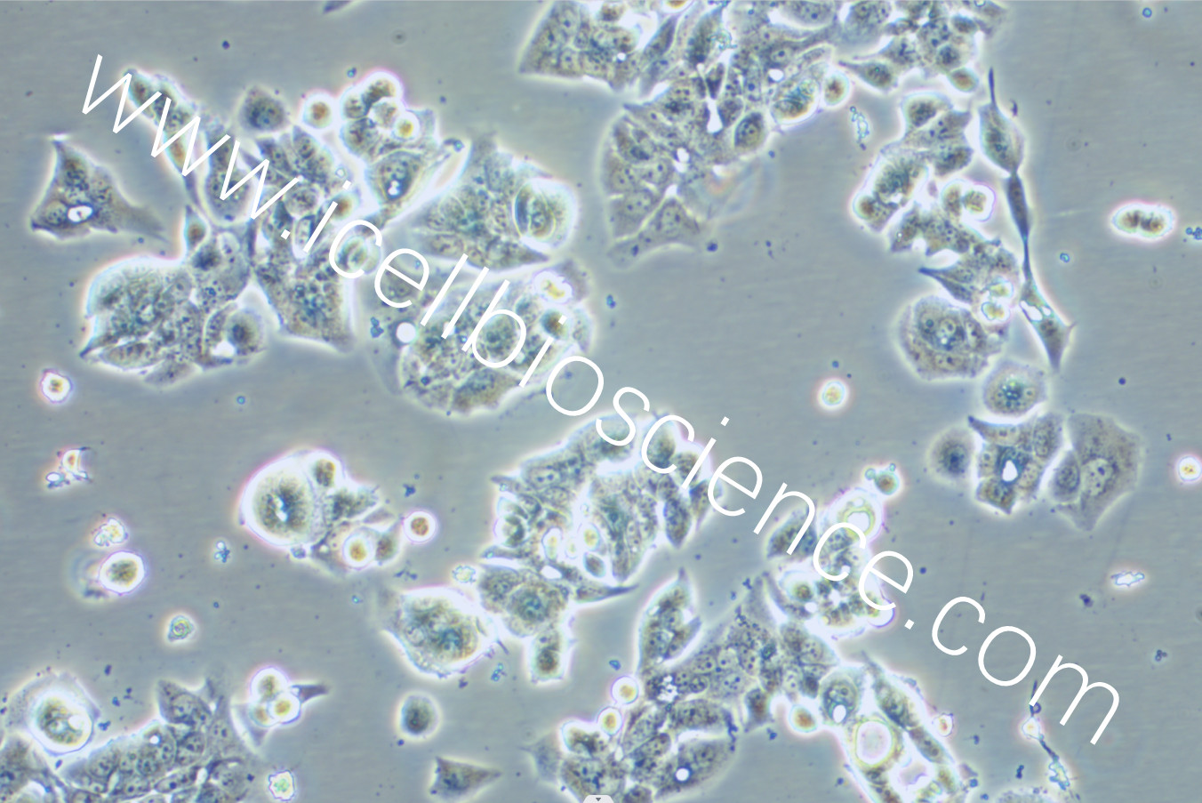 OE19细胞/OE-19细胞/OE-19/OE19/人食管癌细胞