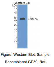 https://msimg.bioon.com/bionline/goods-no-pic.png