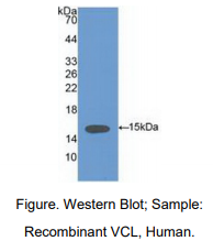 https://msimg.bioon.com/bionline/goods-no-pic.png