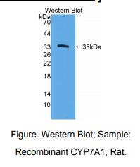 大鼠细胞色素P450家族成员7A1(CYP7A1)多克隆抗体
