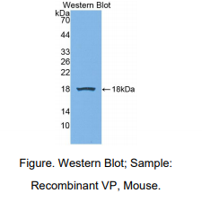 https://msimg.bioon.com/bionline/goods-no-pic.png