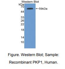 人血小板亲和蛋白1(PKP1)多克隆抗体