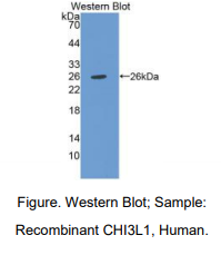 人软骨糖蛋白39(CHI3L1)多克隆抗体