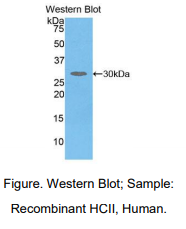 https://msimg.bioon.com/bionline/goods-no-pic.png