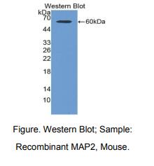 https://msimg.bioon.com/bionline/goods-no-pic.png