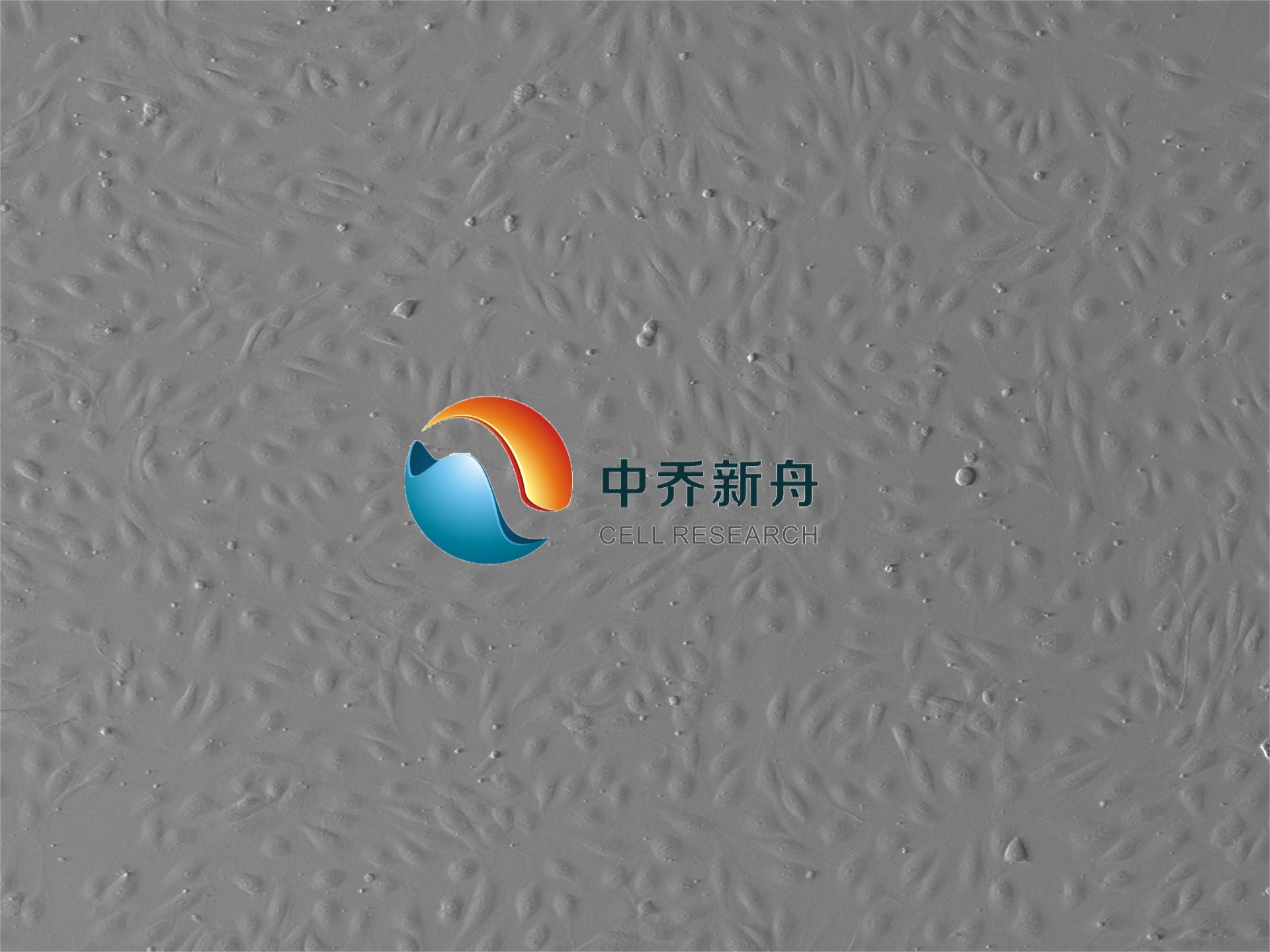 https://img.medsci.cn/8eee53bbc4cb7a98de615e72115896bc4e27fda5cbb764dbd67d9d641c2bb46a.png