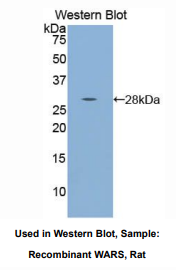 大鼠色氨酰tRNA合成酶(WARS)多克隆抗体