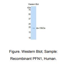 人抑丝蛋白1(PFN1)多克隆抗体