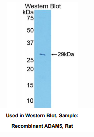 大鼠解整合素金属蛋白酶5(ADAM5)多克隆抗体