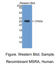 人甲硫氨酸亚砜还原酶A(MSRA)多克隆抗体