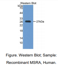 https://msimg.bioon.com/bionline/goods-no-pic.png