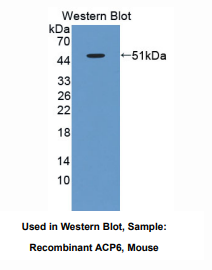 https://msimg.bioon.com/bionline/goods-no-pic.png