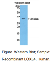 https://msimg.bioon.com/bionline/goods-no-pic.png