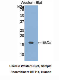 人角蛋白15(CK15)多克隆抗体