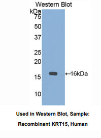 https://msimg.bioon.com/bionline/goods-no-pic.png