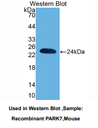 https://msimg.bioon.com/bionline/goods-no-pic.png