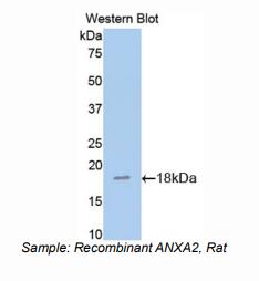 大鼠膜联蛋白A2(ANXA2)多克隆抗体
