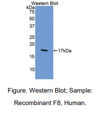 人凝血因子Ⅷ(F8)多克隆抗体