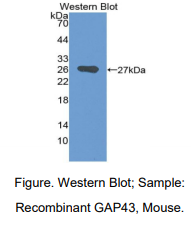 https://msimg.bioon.com/bionline/goods-no-pic.png