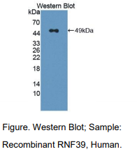 人环指蛋白39(RNF39)多克隆抗体