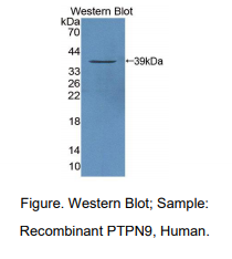 https://msimg.bioon.com/bionline/goods-no-pic.png