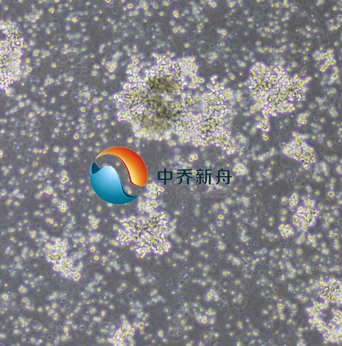 DU4475人乳腺上皮细胞（STR鉴定）