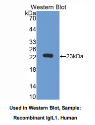 https://msimg.bioon.com/bionline/goods-no-pic.png