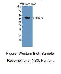 https://msimg.bioon.com/bionline/goods-no-pic.png