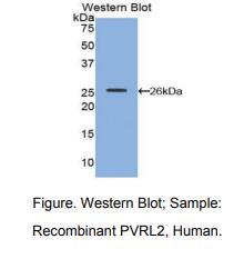 https://msimg.bioon.com/bionline/goods-no-pic.png